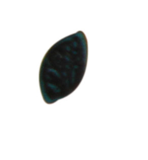 buttons