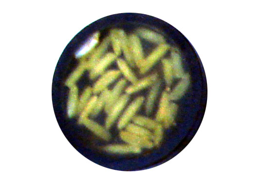 buttons