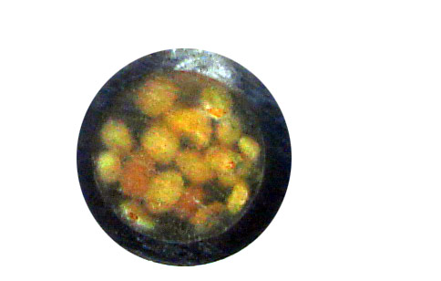 buttons