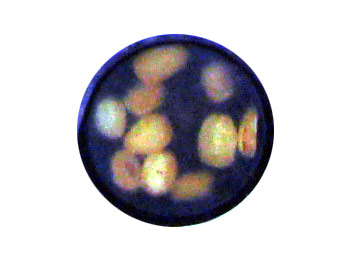 buttons